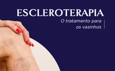 Escleroterapia