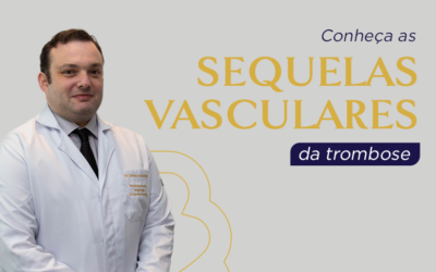 Conheça as sequelas vasculares da trombose.