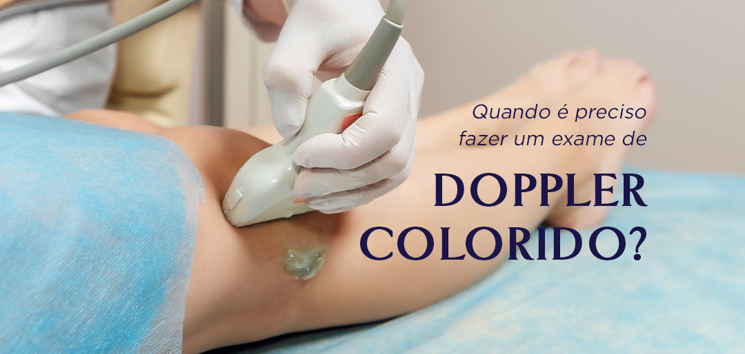 Quando é preciso fazer um exame de doppler colorido?