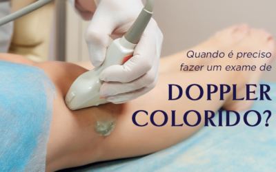 Quando é preciso fazer um exame de doppler colorido?