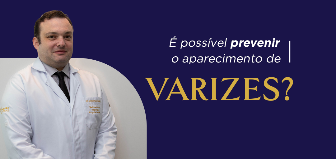 É possível prevenir o aparecimento de varizes?