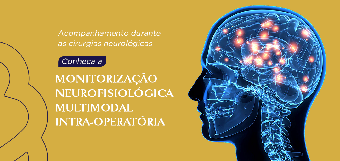 Conheça a Monitorização Neurofisiológica Multimodal Intra-Operatória