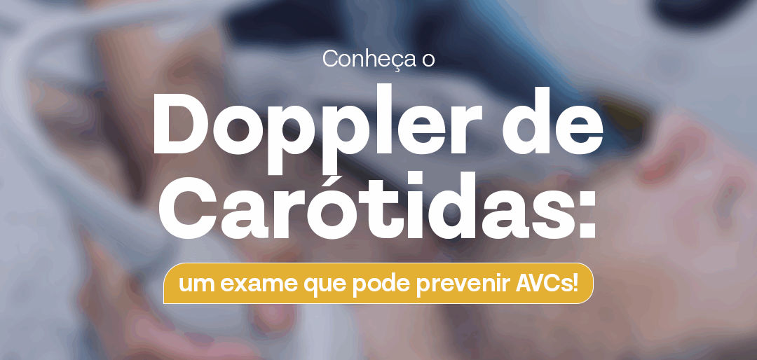 Doppler de Carótidas: O Exame Que Pode Prevenir um AVC