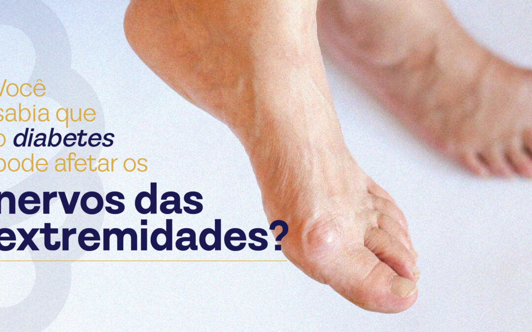 Neuropatia Periférica Diabética: uma das complicações mais comuns do Diabetes
